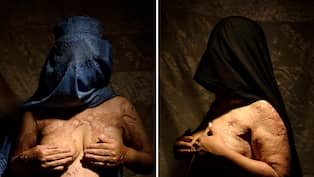 kvinnor nakna afghanistan