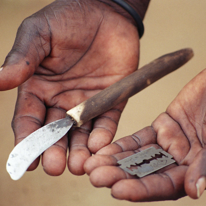 könsstympning Kvinnlig