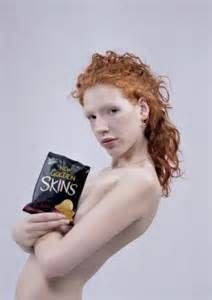 naken albino flicka