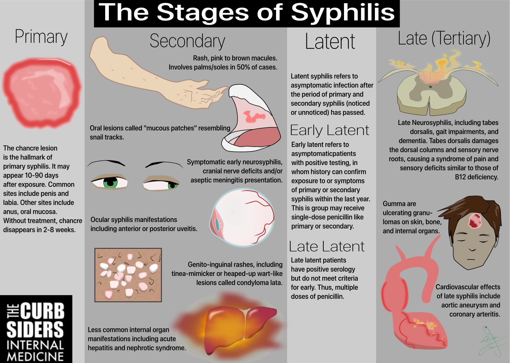 chancre primär syfilis