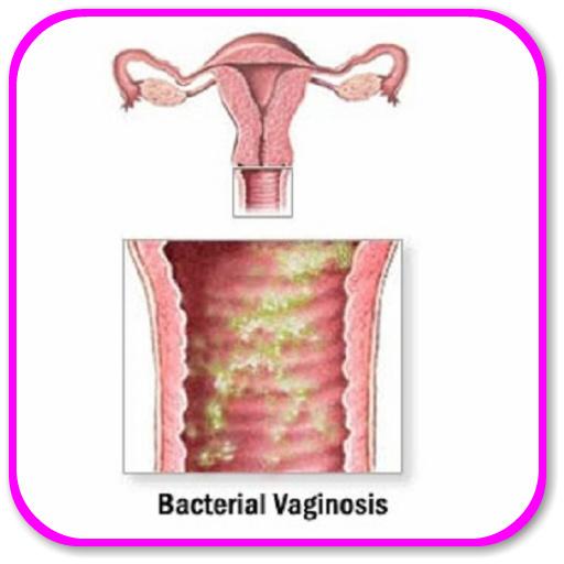 vaginal inflammation obehandlad