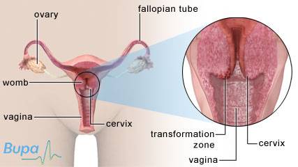 svans kvinna livmoderhals