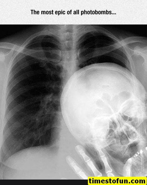 röntgenbilder voyeur