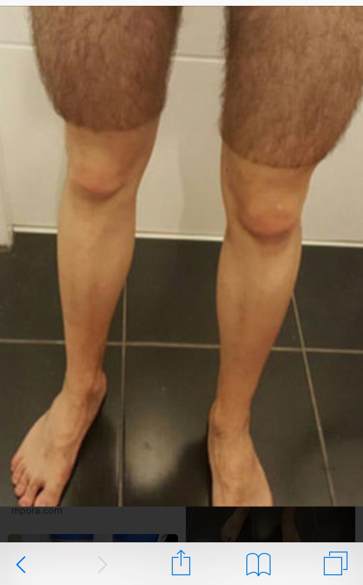 benen transvestiter rakar